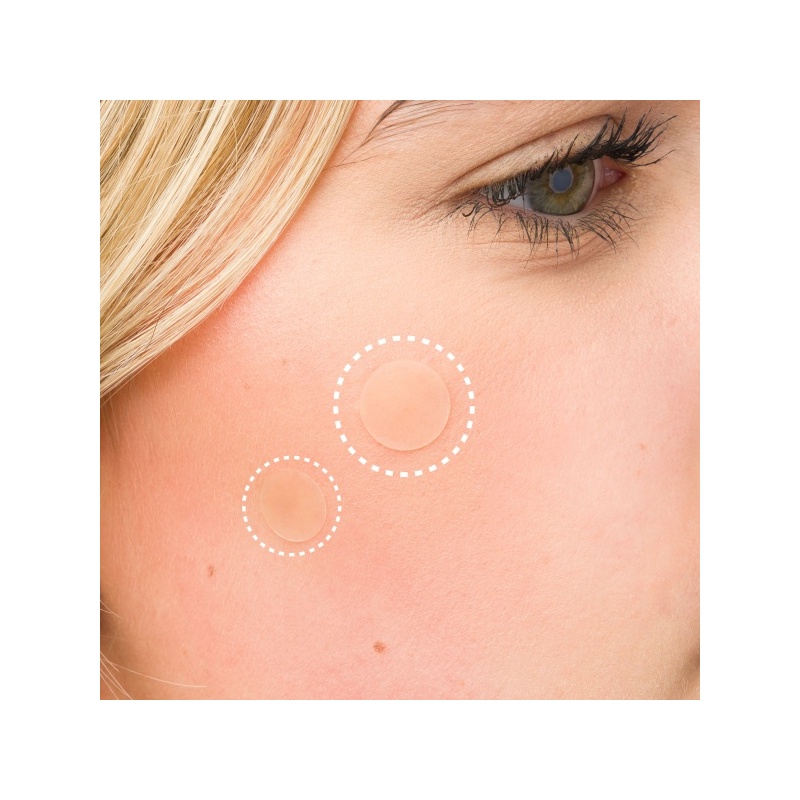 25910-52_56_531_brushworks_breakout_barrier_hydrocolloid_spot_patches_ms__1_.jpg