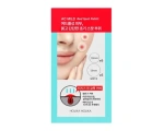 Holika Holika AC MILD Red Spot Patch Патчи против воспалений 12шт