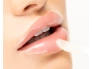26396-06-10-531-killer-lips-lip-plumping-treatment-ms-1-.jpg.webp