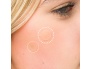 25910-52_56_531_brushworks_breakout_barrier_hydrocolloid_spot_patches_ms__1_.jpg